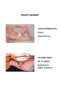 Spritzstellen
